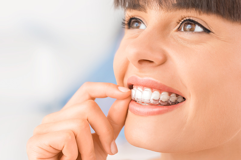 Clear Correct and Invisalign Clear Aligners in Fresno