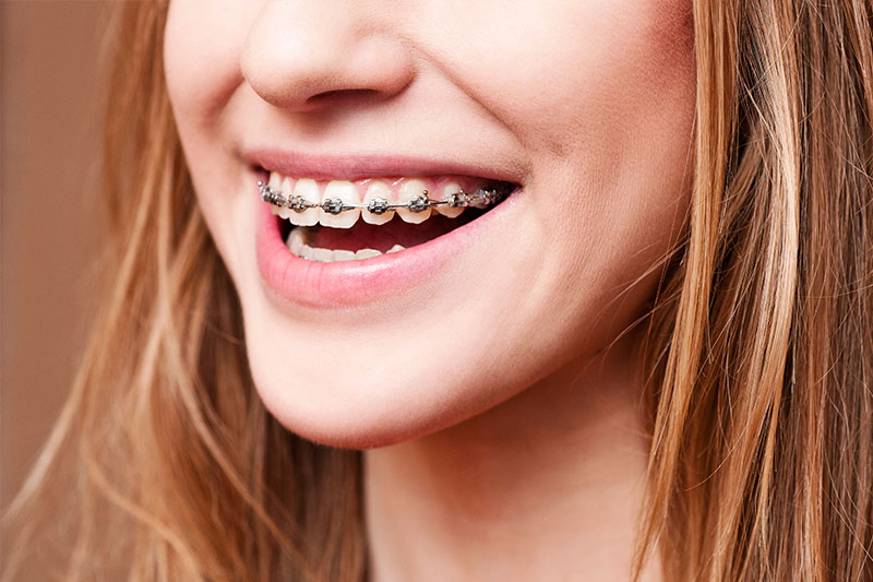 Orthodontics in Fresno